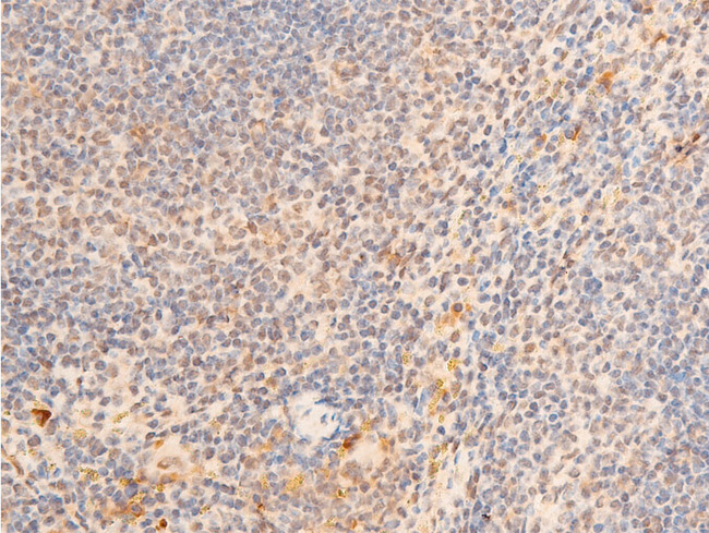 LMNA / Lamin A+C Antibody - 1:100 staining mouse spleen tissue by IHC-P. The tissue was formaldehyde fixed and a heat mediated antigen retrieval step in citrate buffer was performed. The tissue was then blocked and incubated with the antibody for 1.5 hours at 22°C. An HRP conjugated goat anti-rabbit antibody was used as the secondary.
