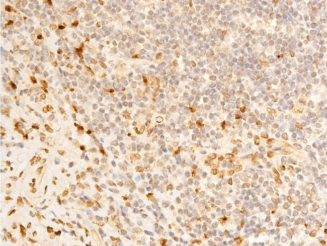 LMNA / Lamin A+C Antibody - 1:100 staining human appendix tissue by IHC-P. The tissue was formaldehyde fixed and a heat mediated antigen retrieval step in citrate buffer was performed. The tissue was then blocked and incubated with the antibody for 1.5 hours at 22°C. An HRP conjugated goat anti-rabbit antibody was used as the secondary.