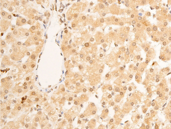 LMNA / Lamin A+C Antibody - 1:100 staining human liver tissue by IHC-P. The tissue was formaldehyde fixed and a heat mediated antigen retrieval step in citrate buffer was performed. The tissue was then blocked and incubated with the antibody for 1.5 hours at 22°C. An HRP conjugated goat anti-rabbit antibody was used as the secondary.