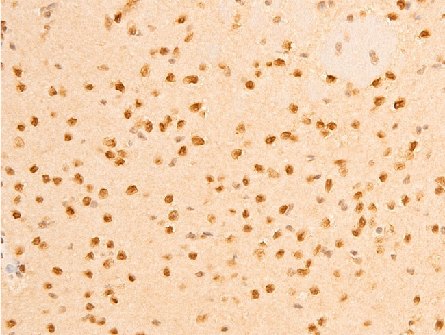 LMNA / Lamin A+C Antibody - 1:100 staining mouse brain tissue by IHC-P. The tissue was formaldehyde fixed and a heat mediated antigen retrieval step in citrate buffer was performed. The tissue was then blocked and incubated with the antibody for 1.5 hours at 22°C. An HRP conjugated goat anti-rabbit antibody was used as the secondary.