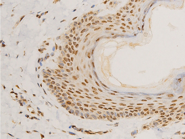 LMNA / Lamin A+C Antibody - 1:100 staining human skin tissue by IHC-P. The tissue was formaldehyde fixed and a heat mediated antigen retrieval step in citrate buffer was performed. The tissue was then blocked and incubated with the antibody for 1.5 hours at 22°C. An HRP conjugated goat anti-rabbit antibody was used as the secondary.