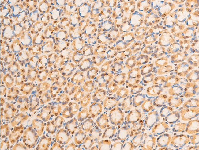 LMNA / Lamin A+C Antibody - 1:100 staining rat gastric tissue by IHC-P. The tissue was formaldehyde fixed and a heat mediated antigen retrieval step in citrate buffer was performed. The tissue was then blocked and incubated with the antibody for 1.5 hours at 22°C. An HRP conjugated goat anti-rabbit antibody was used as the secondary.