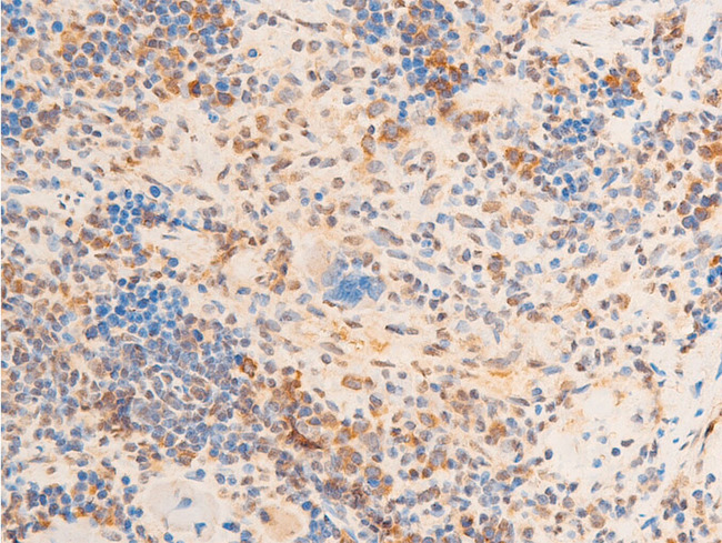 LMNA / Lamin A+C Antibody - 1:100 staining rat spleen tissue by IHC-P. The tissue was formaldehyde fixed and a heat mediated antigen retrieval step in citrate buffer was performed. The tissue was then blocked and incubated with the antibody for 1.5 hours at 22°C. An HRP conjugated goat anti-rabbit antibody was used as the secondary.