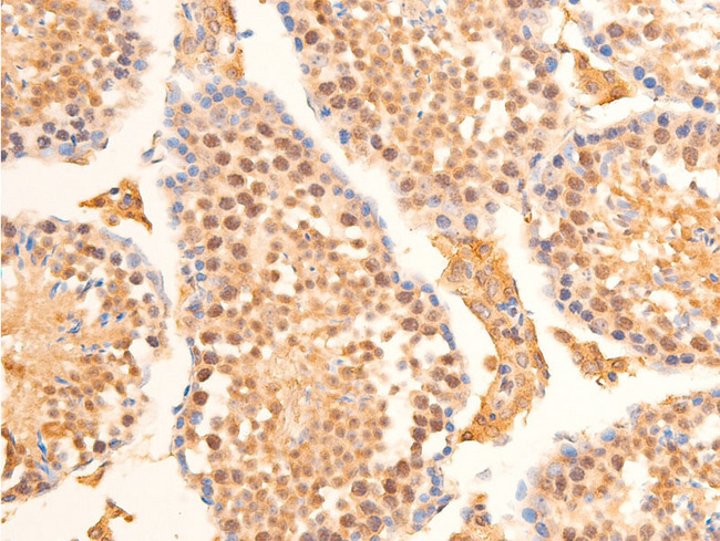 LMNA / Lamin A+C Antibody - 1:100 staining mouse testis tissue by IHC-P. The tissue was formaldehyde fixed and a heat mediated antigen retrieval step in citrate buffer was performed. The tissue was then blocked and incubated with the antibody for 1.5 hours at 22°C. An HRP conjugated goat anti-rabbit antibody was used as the secondary.
