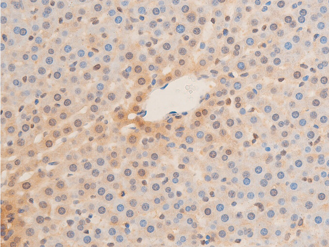 LMNA / Lamin A+C Antibody - 1:100 staining rat liver tissue by IHC-P. The tissue was formaldehyde fixed and a heat mediated antigen retrieval step in citrate buffer was performed. The tissue was then blocked and incubated with the antibody for 1.5 hours at 22°C. An HRP conjugated goat anti-rabbit antibody was used as the secondary.