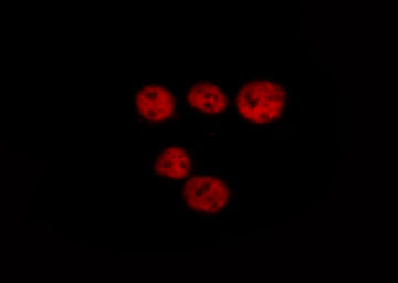 LMNA / Lamin A+C Antibody - Staining HeLa cells by IF/ICC. The samples were fixed with PFA and permeabilized in 0.1% saponin prior to blocking in 10% serum for 45 min at 37°C. The primary antibody was diluted 1/400 and incubated with the sample for 1 hour at 37°C. A Alexa Fluor® 594 conjugated goat polyclonal to rabbit IgG (H+L), diluted 1/600 was used as secondary antibody.