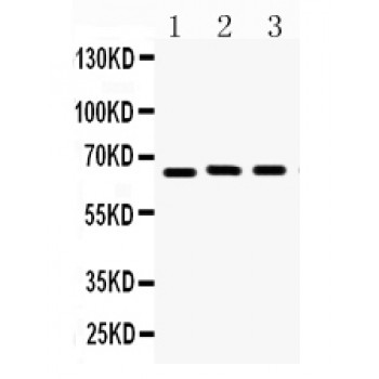 LMNB1 / Lamin B1 Antibody - Lamin B1 antibody Western blot. All lanes: Anti Lamin B1 at 0.5 ug/ml. Lane 1: U87 Whole Cell Lysate at 40 ug. Lane 2: PC-12 Whole Cell Lysate at 40 ug. Lane 3: NIH3T3 Whole Cell Lysate at 40 ug. Predicted band size: 67 kD. Observed band size: 67 kD.
