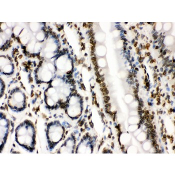 LMNB1 / Lamin B1 Antibody - Lamin B1 antibody IHC-paraffin. IHC(P): Rat Intestine Tissue.