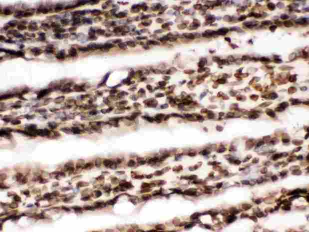 LMNB1 / Lamin B1 Antibody - IHC analysis of Lamin B1 using anti-Lamin B1 antibody. Lamin B1 was detected in frozen section of rat small intestine tissue. Heat mediated antigen retrieval was performed in citrate buffer (pH6, epitope retrieval solution) for 20 mins. The tissue section was blocked with 10% goat serum. The tissue section was then incubated with 1µg/ml rabbit anti-Lamin B1 Antibody overnight at 4°C. Biotinylated goat anti-rabbit IgG was used as secondary antibody and incubated for 30 minutes at 37°C. The tissue section was developed using Strepavidin-Biotin-Complex (SABC) with DAB as the chromogen.