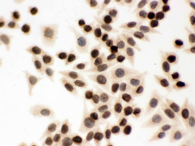 LMNB1 / Lamin B1 Antibody - IHC analysis of Lamin B1 using anti-Lamin B1 antibody. Lamin B1 was detected in immunocytochemical section of SMMC-7721 cell. Heat mediated antigen retrieval was performed in citrate buffer (pH6, epitope retrieval solution) for 20 mins. The tissue section was blocked with 10% goat serum. The tissue section was then incubated with 1µg/ml rabbit anti-Lamin B1 Antibody overnight at 4°C. Biotinylated goat anti-rabbit IgG was used as secondary antibody and incubated for 30 minutes at 37°C. The tissue section was developed using Strepavidin-Biotin-Complex (SABC) with DAB as the chromogen.