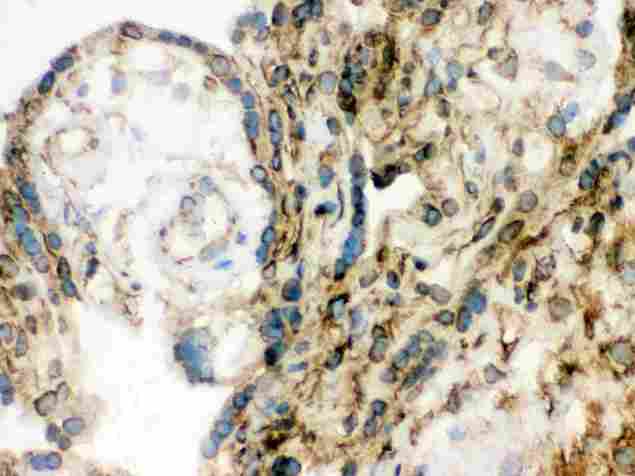 LMNB1 / Lamin B1 Antibody - IHC analysis of Lamin B1 using anti-Lamin B1 antibody. Lamin B1 was detected in frozen section of human placenta tissue . Heat mediated antigen retrieval was performed in citrate buffer (pH6, epitope retrieval solution) for 20 mins. The tissue section was blocked with 10% goat serum. The tissue section was then incubated with 1µg/ml rabbit anti-Lamin B1 Antibody overnight at 4°C. Biotinylated goat anti-rabbit IgG was used as secondary antibody and incubated for 30 minutes at 37°C. The tissue section was developed using Strepavidin-Biotin-Complex (SABC) with DAB as the chromogen.