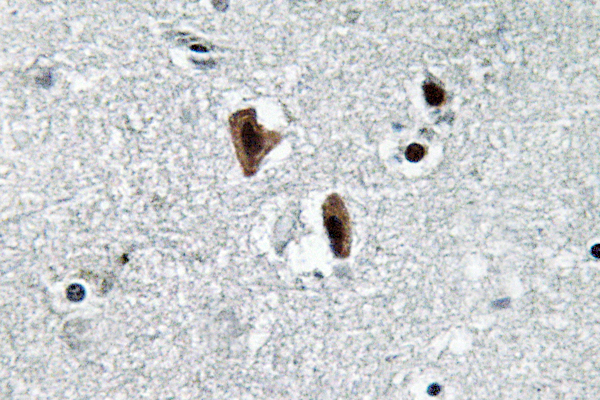 LMNB1 / Lamin B1 Antibody - IHC of Lamin B1 (L75) pAb in paraffin-embedded human brain tissue.