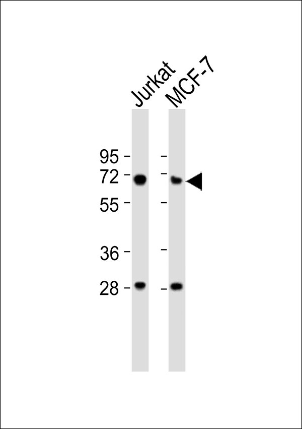 LMNB1 / Lamin B1 Antibody - All lanes : Anti-Lamin B1 Antibody at 1:1000 dilution Lane 1: Jurkat whole cell lysates Lane 2: MCF-7 whole cell lysates Lysates/proteins at 20 ug per lane. Secondary Goat Anti-Rabbit IgG, (H+L),Peroxidase conjugated at 1/10000 dilution Predicted band size : 66 kDa Blocking/Dilution buffer: 5% NFDM/TBST.