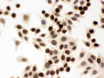 LMNB1 / Lamin B1 Antibody - ICC testing of FFPE human SMMC-7721 cells with LMNB1 antibody. HIER: Boil the paraffin sections in pH 6, 10mM citrate buffer for 20 minutes and allow to cool prior to staining.