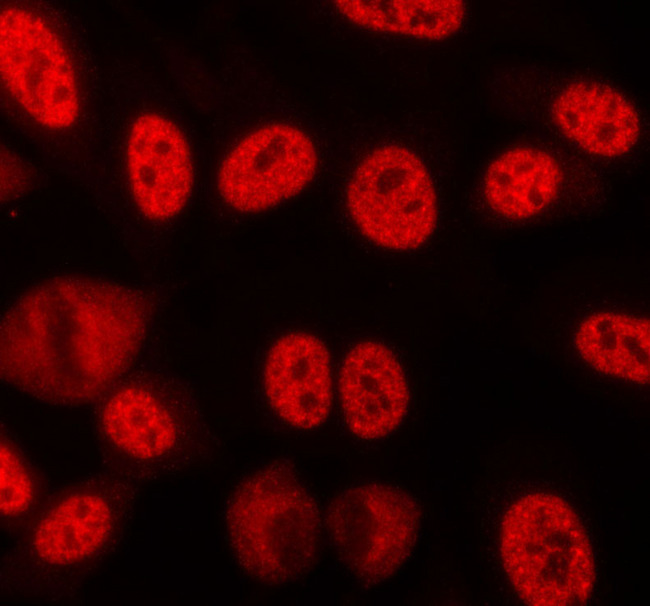 LMNB1 / Lamin B1 Antibody - Staining LOVO cells by IF/ICC. The samples were fixed with PFA and permeabilized in 0.1% saponin prior to blocking in 10% serum for 45 min at 37°C. The primary antibody was diluted 1/400 and incubated with the sample for 1 hour at 37°C. A Alexa Fluor® 594 conjugated goat polyclonal to rabbit IgG (H+L), diluted 1/600 was used as secondry antibody