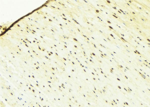 LMNB1 / Lamin B1 Antibody - 1:100 staining mouse brain tissue by IHC-P. The sample was formaldehyde fixed and a heat mediated antigen retrieval step in citrate buffer was performed. The sample was then blocked and incubated with the antibody for 1.5 hours at 22°C. An HRP conjugated goat anti-rabbit antibody was used as the secondary.