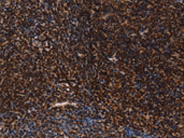 LMNB1 / Lamin B1 Antibody - Immunohistochemistry of paraffin-embedded Human tonsil tissue  using LMNB1 Polyclonal Antibody at dilution of 1:60(×200)
