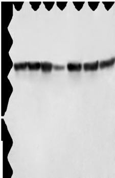 LMNB1 / Lamin B1 Antibody - Western blot analysis of Hela cells HT29 cells human fetal liver tissue Human testis tissue 231 cells K562 cells human bladder transitional cell carcinoma tissue  using LMNB1 Polyclonal Antibody at dilution of 1:750