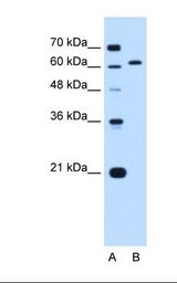 LMNB2 / Lamin B2 Antibody - Lane A: Marker. Lane B: Jurkat cell lysate. Antibody concentration: 0.25 ug/ml. Gel concentration: 12%.  This image was taken for the unconjugated form of this product. Other forms have not been tested.