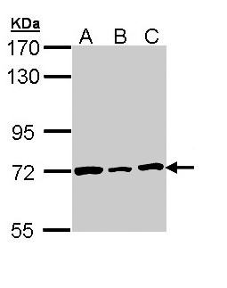LMNB2 / Lamin B2 Antibody - Sample (30 ug of whole cell lysate). A: H1299, B: Hela, C: Hep G2 . 7.5% SDS PAGE. LAMB2 / Lamin B2 antibody diluted at 1:1000.