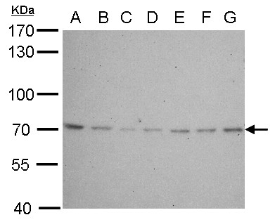LMNB2 / Lamin B2 Antibody - Lamin B2 antibody [N3C2], Internal detects LMNB2 protein by Western blot analysis. A. 30 ug Neuro2A whole cell lysate/extract. B. 30 ug GL261 whole cell lysate/extract. C. 30 ug C8D30 whole cell lysate/extract. D. 30 ug NIH-3T3 whole cell lysate/extract. E. 30 ug BCL-1 lysate/extract. F. 30 ug Raw264.7 whole cell lysate/extract. G. 30 ug C2C12 whole cell lysate/extract. 7.5 % SDS-PAGE. Lamin B2 antibody [N3C2], Internal dilution:1:500