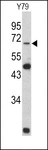 LMNB2 / Lamin B2 Antibody - Western blot of Lamin B2 Antibody in Y79 cell line lysates (35 ug/lane). Lamin B2 (arrow) was detected using the purified antibody.