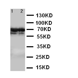 LMNB2 / Lamin B2 Antibody - WB of Lamin B2 antibody. Lane 1: HELA Cell Lysate. Lane 2: U87 Cell Lysate.