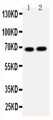 LMNB2 / Lamin B2 Antibody - Anti-Lamin B2 antibody, Western blotting Lane 1: HELA Cell Lysate Lane 2: U87 Cell Lysate