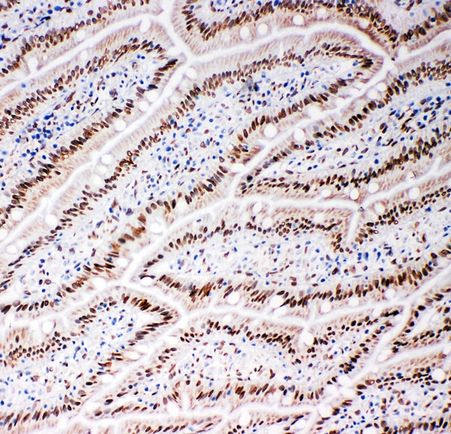 LMNB2 / Lamin B2 Antibody - IHC analysis of Lamin B2 using anti-Lamin B2 antibody. Lamin B2 was detected in frozen section of rat intestine tissues. Heat mediated antigen retrieval was performed in citrate buffer (pH6, epitope retrieval solution) for 20 mins. The tissue section was blocked with 10% goat serum. The tissue section was then incubated with 1µg/ml rabbit anti-Lamin B2 antibody overnight at 4°C. Biotinylated goat anti-rabbit IgG was used as secondary antibody and incubated for 30 minutes at 37°C. The tissue section was developed using Strepavidin-Biotin-Complex (SABC) with DAB as the chromogen.