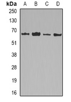 LMNB2 / Lamin B2 Antibody - Western blot analysis of Lamin B2 expression in HepG2 (A); MCF7 (B); mouse liver (C); mouse heart (D) whole cell lysates.