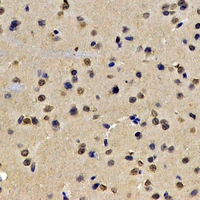 LMNB2 / Lamin B2 Antibody - Immunohistochemical analysis of Lamin B2 staining in rat brain formalin fixed paraffin embedded tissue section. The section was pre-treated using heat mediated antigen retrieval with sodium citrate buffer (pH 6.0). The section was then incubated with the antibody at room temperature and detected using an HRP conjugated compact polymer system. DAB was used as the chromogen. The section was then counterstained with hematoxylin and mounted with DPX.