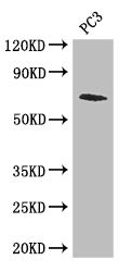 LMNB2 / Lamin B2 Antibody - Positive WB detected in:PC3 whole cell lysate;All lanes: LMNB2 antibody at 2ug/ml;Secondary;Goat polyclonal to rabbit IgG at 1/50000 dilution;Predicted band size: 70 kDa;Observed band size: 70 kDa;