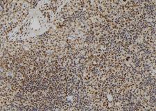 LMNB2 / Lamin B2 Antibody - 1:100 staining mouse spleen tissue by IHC-P. The sample was formaldehyde fixed and a heat mediated antigen retrieval step in citrate buffer was performed. The sample was then blocked and incubated with the antibody for 1.5 hours at 22°C. An HRP conjugated goat anti-rabbit antibody was used as the secondary.
