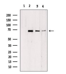 LMNB2 / Lamin B2 Antibody - Western blot analysis of extracts of various samples using LMNB2 antibody. Lane 1: mouse brain treated with blocking peptide. Lane 2: mouse brain; Lane 3: HeLa; Lane 4: HepG2;