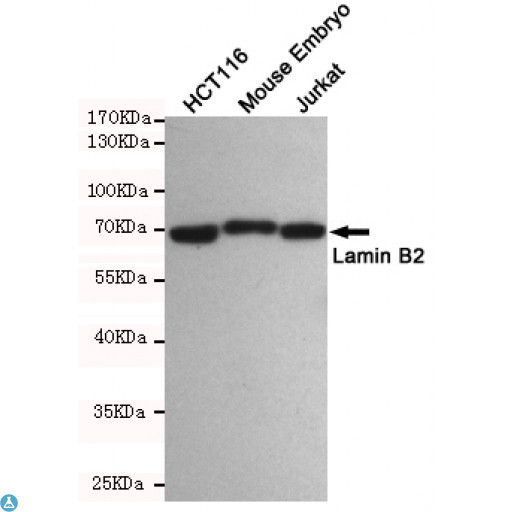 LMNB2 / Lamin B2 Antibody - Western blot detection of Lamin B2 in HCT116, Mouse Embryo and Jurkat cell lysates using Lamin B2 mouse mAb (dilution 1:500). Predicted band size: 68kDa. Observed band size: 68kDa.