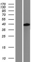LMNTD1 / IFLTD1 Protein - Western validation with an anti-DDK antibody * L: Control HEK293 lysate R: Over-expression lysate