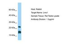 LMO1 Antibody -  This image was taken for the unconjugated form of this product. Other forms have not been tested.