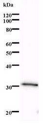 LMO1 Antibody - Western blot of immunized recombinant protein using LMO1 antibody.