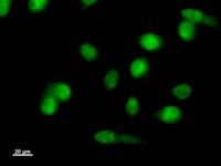 LMO1 Antibody - Immunostaining analysis in HeLa cells. HeLa cells were fixed with 4% paraformaldehyde and permeabilized with 0.1% Triton X-100 in PBS. The cells were immunostained with anti-LMO1 mAb.