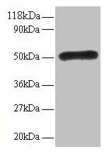 LMO1 Antibody - Western blot All lanes: Rhombotin-1 antibody at 2µg/ml Lane 1: EC109 whole cell lysate Lane 2: 293T whole cell lysate Secondary Goat polyclonal to rabbit IgG at 1/15000 dilution Predicted band size: 17 kDa Observed band size: 50 kDa