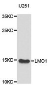 LMO1 Antibody - Western blot analysis of extracts of U251 cells.
