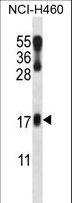 LMO2 Antibody - LMO2 Antibody western blot of NCI-H460 cell line lysates (35 ug/lane). The LMO2 antibody detected the LMO2 protein (arrow).