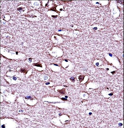 LMO2 Antibody - LMO2 Antibody immunohistochemistry of formalin-fixed and paraffin-embedded human brain tissue followed by peroxidase-conjugated secondary antibody and DAB staining.