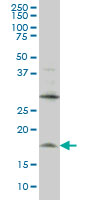LMO2 Antibody - LMO2 monoclonal antibody (M01), clone 6B8 Western Blot analysis of LMO2 expression in HL-60.