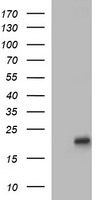 LMO2 Antibody - HEK293T cells were transfected with the pCMV6-ENTRY control (Left lane) or pCMV6-ENTRY LMO2 (Right lane) cDNA for 48 hrs and lysed. Equivalent amounts of cell lysates (5 ug per lane) were separated by SDS-PAGE and immunoblotted with anti-LMO2.