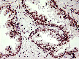 LMO2 Antibody - IHC of paraffin-embedded Human prostate tissue using anti-LMO2 mouse monoclonal antibody. (Heat-induced epitope retrieval by 10mM citric buffer, pH6.0, 120°C for 3min).