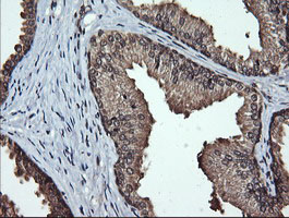 LMO2 Antibody - IHC of paraffin-embedded Human prostate tissue using anti-LMO2 mouse monoclonal antibody.