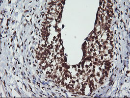 LMO2 Antibody - IHC of paraffin-embedded Human bladder tissue using anti-LMO2 mouse monoclonal antibody.