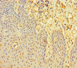 LMO2 Antibody - Immunohistochemistry of paraffin-embedded human tonsil tissue at dilution of 1:100