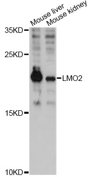 LMO2 Antibody - Western blot analysis of extracts of various cell lines, using LMO2 antibody at 1:3000 dilution. The secondary antibody used was an HRP Goat Anti-Rabbit IgG (H+L) at 1:10000 dilution. Lysates were loaded 25ug per lane and 3% nonfat dry milk in TBST was used for blocking. An ECL Kit was used for detection and the exposure time was 90s.